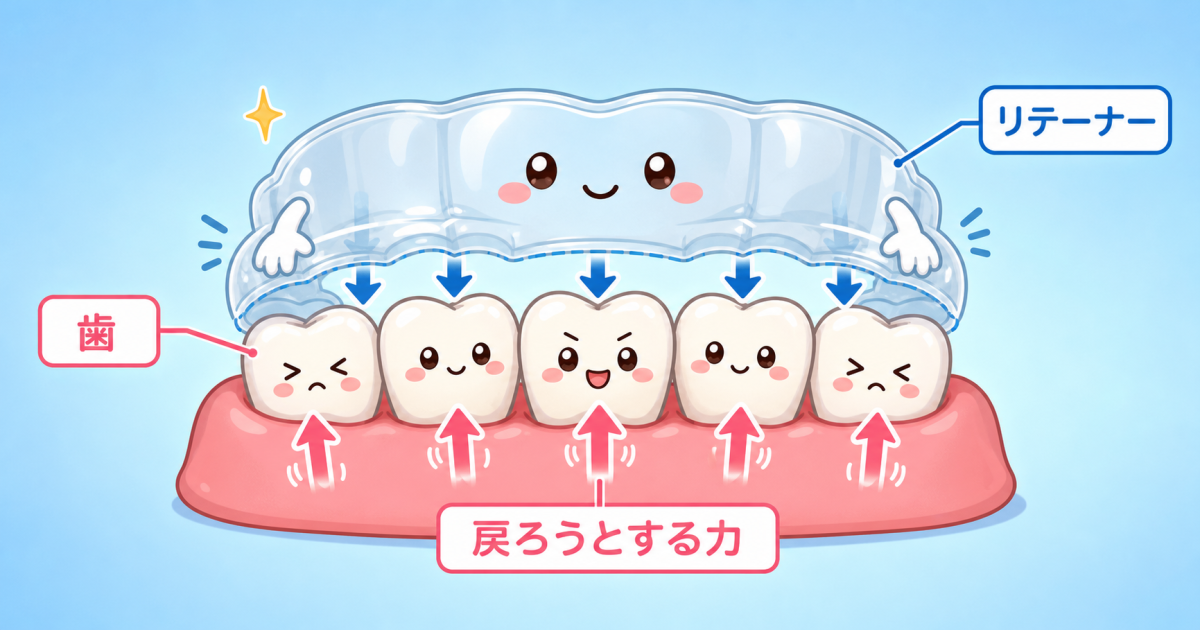 ■リテーナー(保定装置)の役割と後戻りが起こる理由