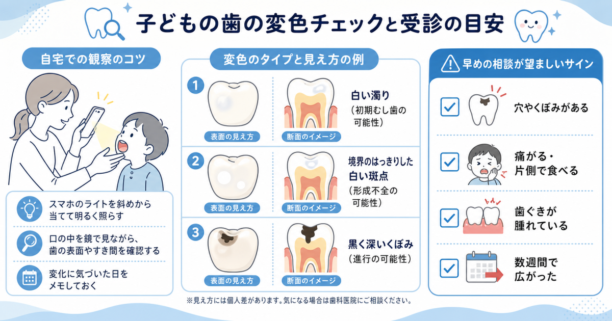 子どもの歯に見られる「白い斑点」「黒い点」の原因とむし歯の見分け方